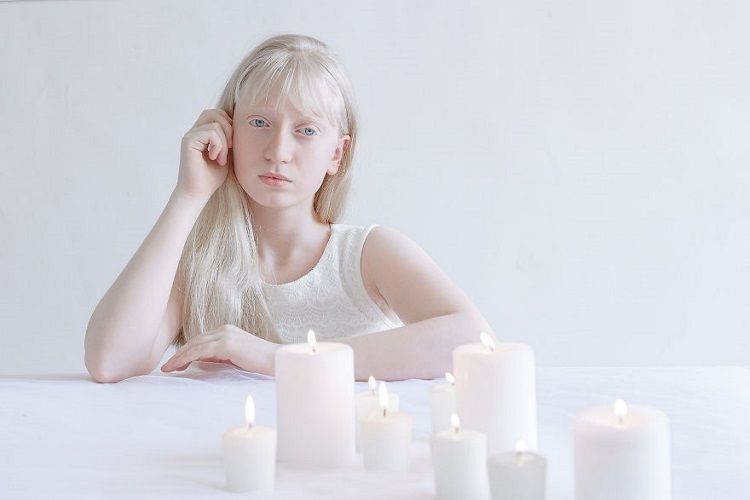 Fotografer ini Memotret Para Albino dan Hasilnya Sangat Menakjubkan