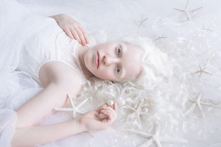Fotografer ini Memotret Para Albino dan Hasilnya Sangat Menakjubkan