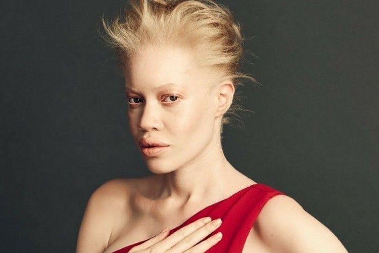 Bangga dengan Dirinya, 3 Wanita Albino Ini Berbagi Tips Makeup