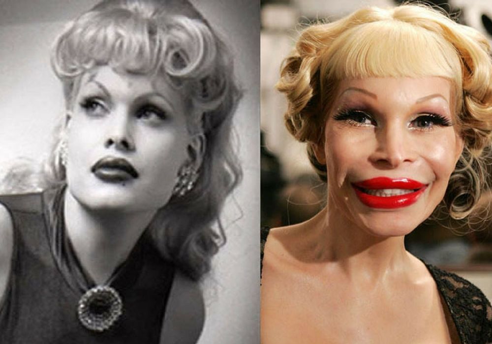Addicted to plastic surgery, the 7 faces of the world singer are becoming more and more amazing