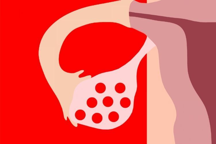 Ketahui 10 Alasan Mengapa Vagina Sakit Saat Berhubungan Intim
