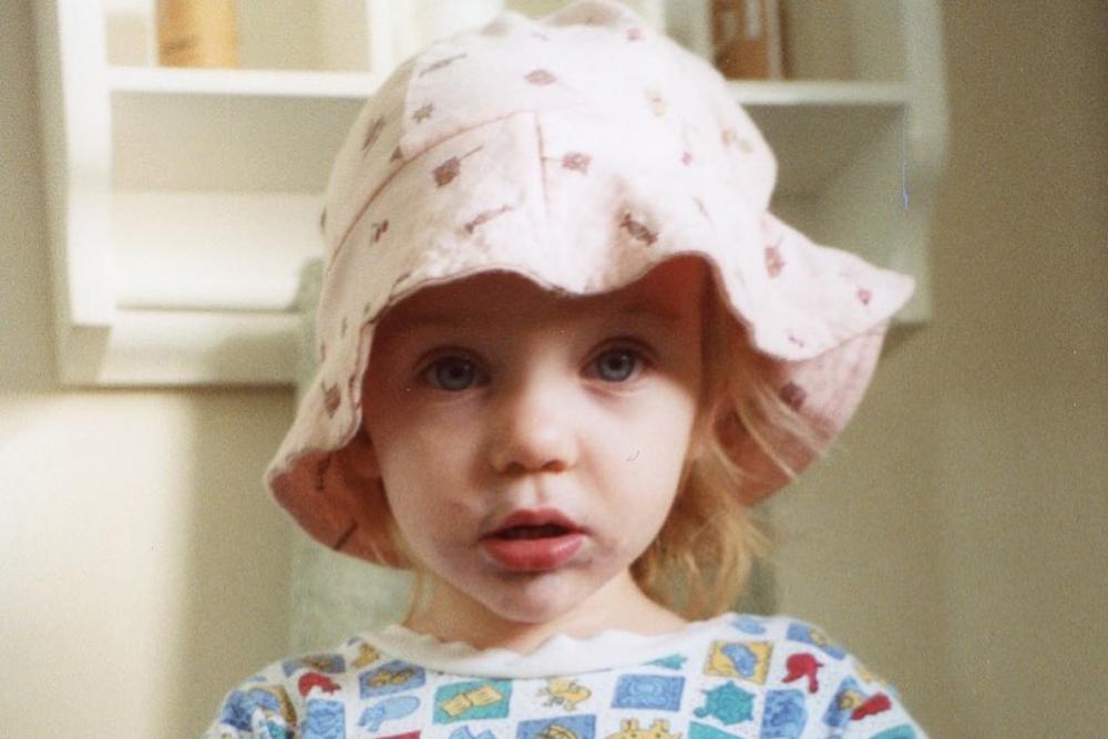 Billie Eilish Mengaku Alami Sindrom Tourette, Penyakit Apakah Itu?