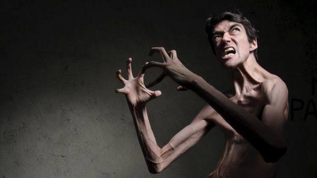 Langka Banget! 8 Manusia Ini Dianugerahi Kekuatan Super yang Aneh