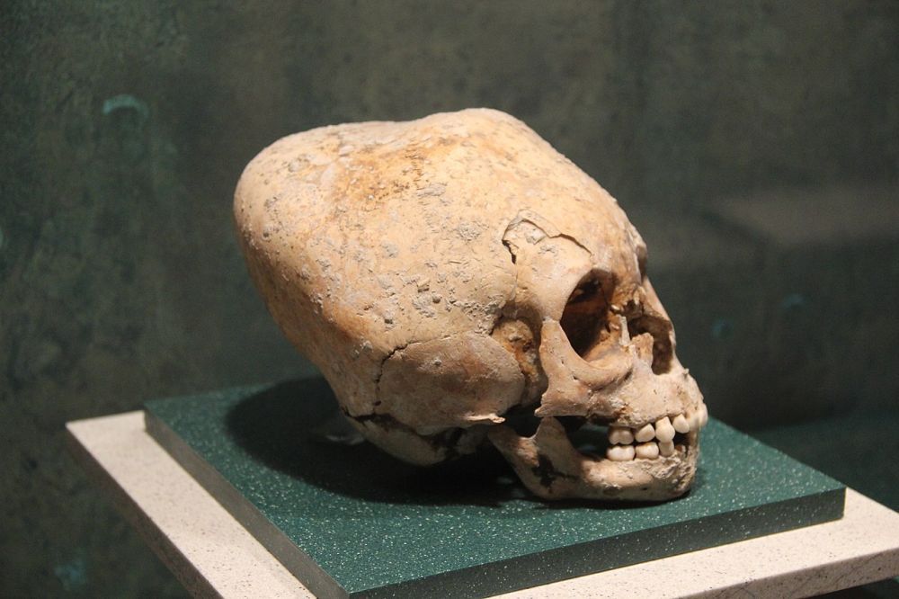 Often mistaken for aliens, 7 tribes with unusual skull shapes
